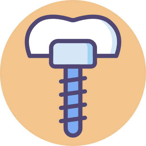 Procedimentos Odontológicos - Implante de Dentes