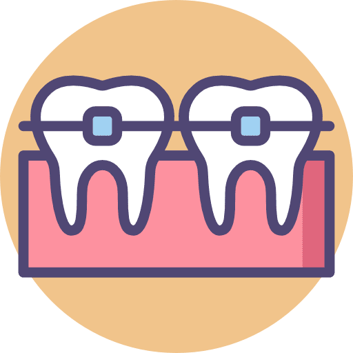 Procedimentos Odontológicos - Ortodontia - Aparelho Dental